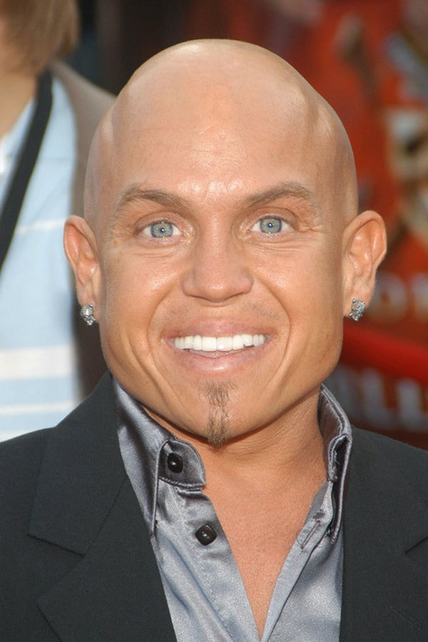 Foto de Martin Klebba pareja de Michelle Dilgard